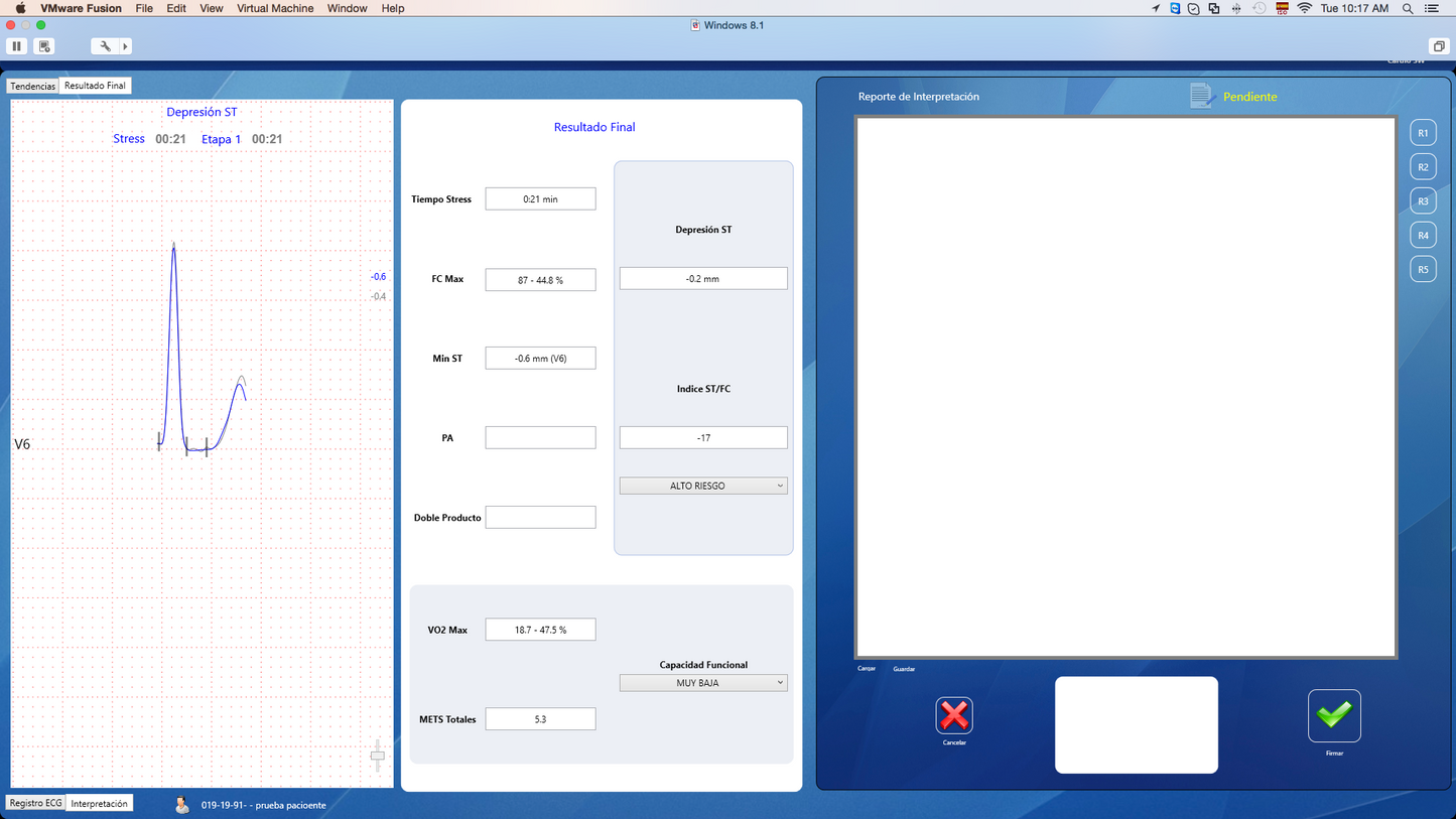 CardioSW - Stress Test, Interpretation Software - Medical equipment / Equipo medico - Mediventa USA