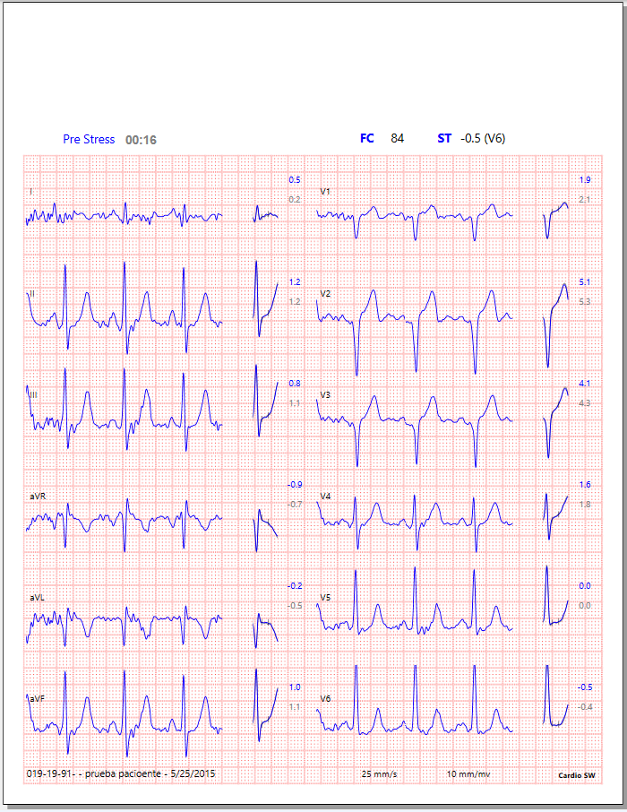 ECG Cardioview CV1200