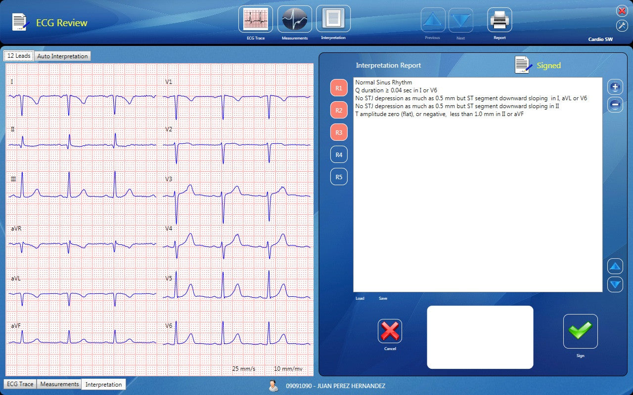 CardioSW - Rest ECG, Interpretation Software - Medical equipment / Equipo medico - Mediventa USA