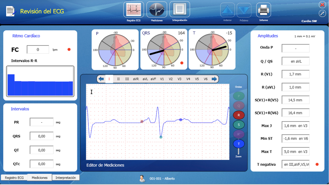 ECG Cardioview CV200