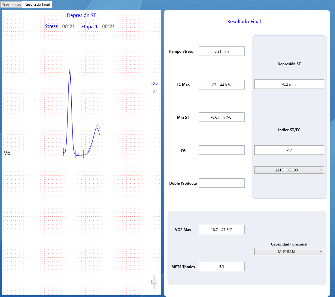 ECG Cardioview CV1200