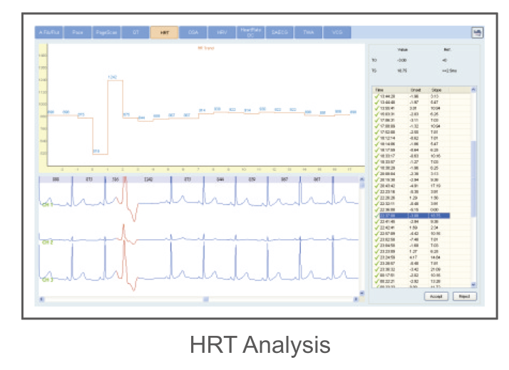 CardioSW - Holter, Interpretation Software - Medical equipment / Equipo medico - Mediventa USA