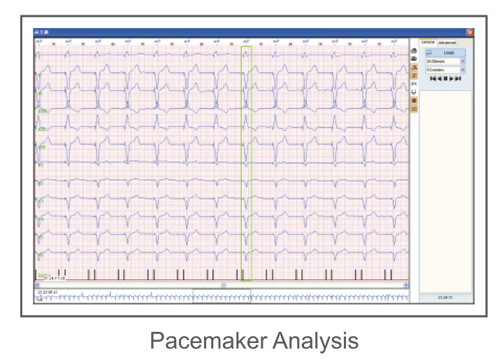 CardioSW - Holter, Interpretation Software - Medical equipment / Equipo medico - Mediventa USA