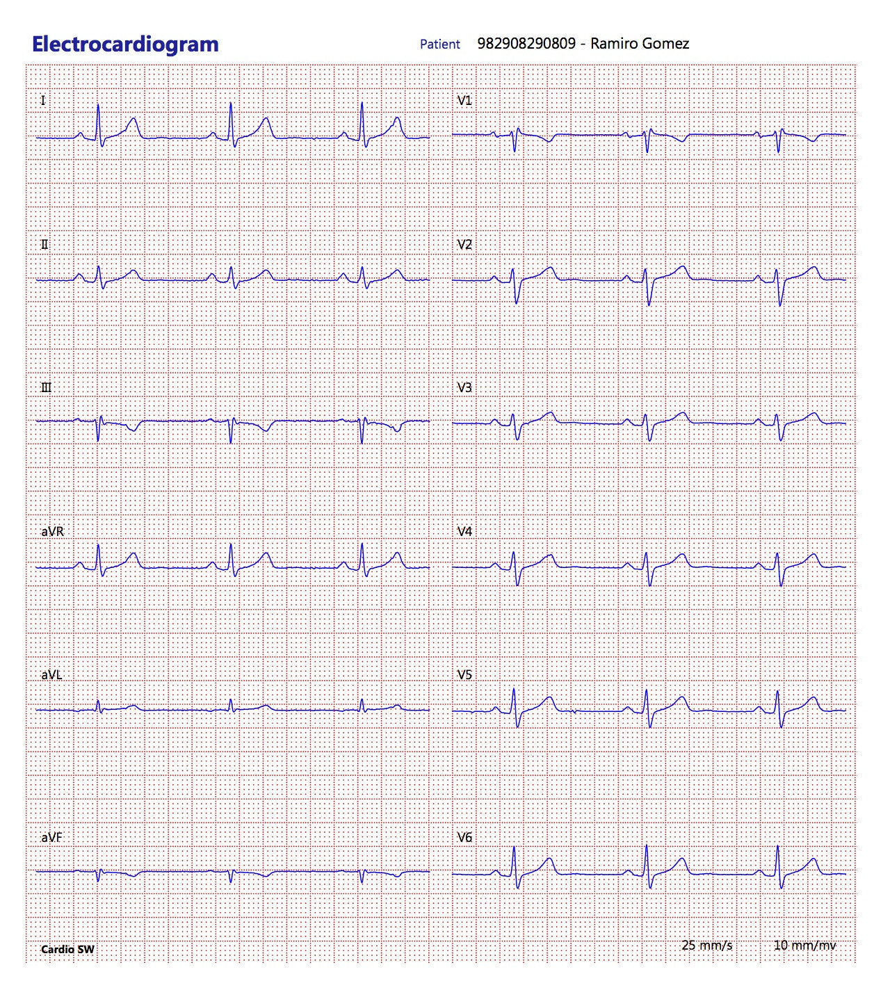 CardioSW - Rest ECG, Interpretation Software - Medical equipment / Equipo medico - Mediventa USA