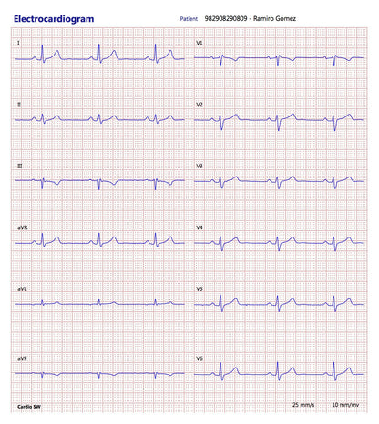 CardioSW - Rest ECG, Interpretation Software - Medical equipment / Equipo medico - Mediventa USA