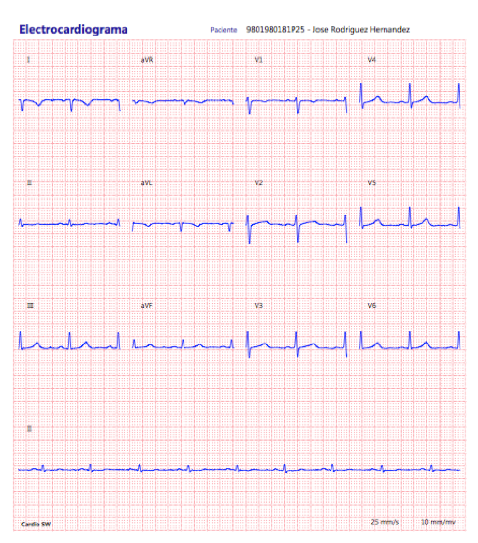 ECG Cardioview CV200