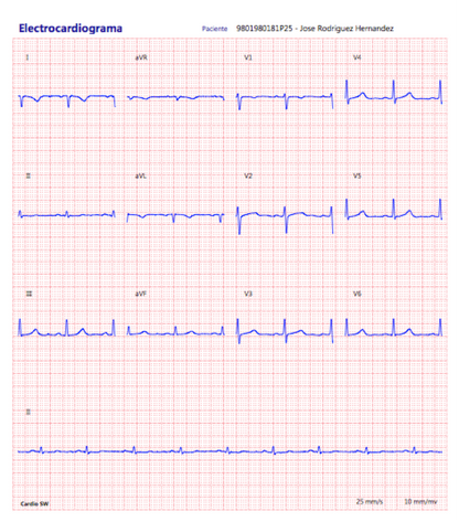 ECG Cardioview CV200