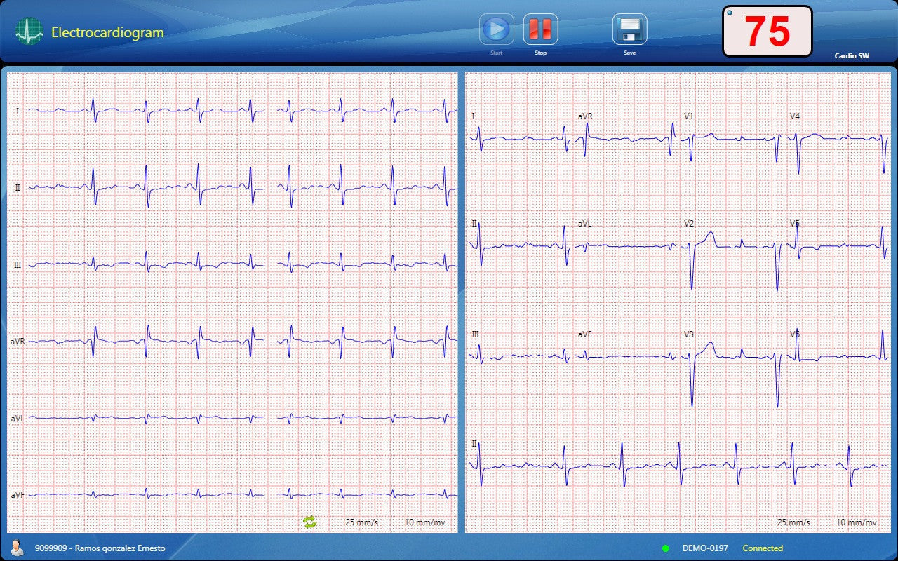 CardioSW - Rest ECG, Interpretation Software - Medical equipment / Equipo medico - Mediventa USA