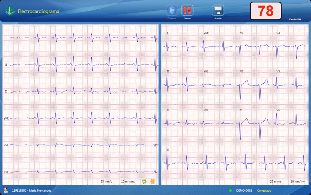 ECG Cardioview CV200
