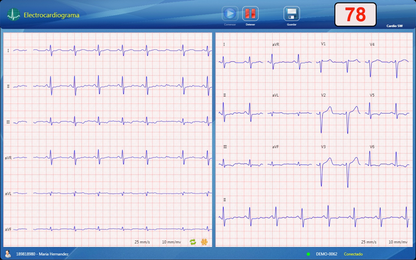 ECG Cardioview CV200