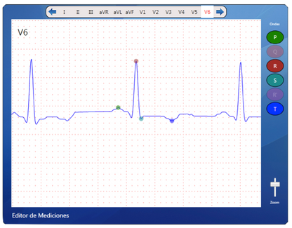 ECG Cardioview CV200