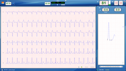 CardioSW - Stress Test, Interpretation Software - Medical equipment / Equipo medico - Mediventa USA