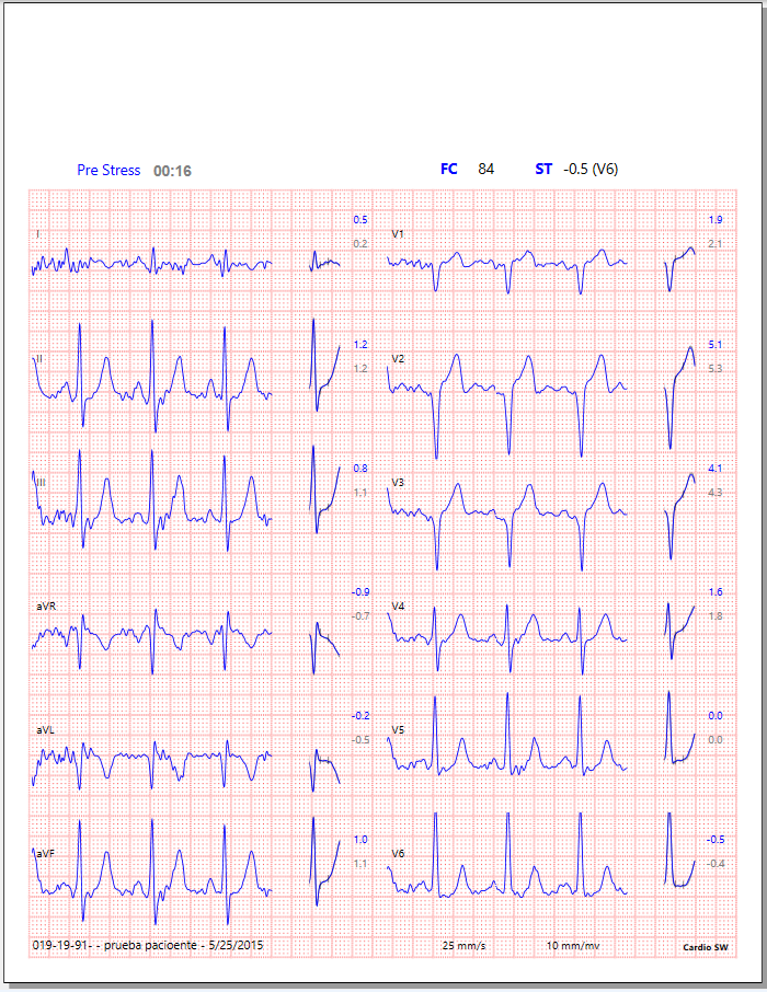 CardioSW - Stress Test, Interpretation Software - Medical equipment / Equipo medico - Mediventa USA