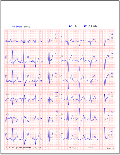 CardioSW - Stress Test, Interpretation Software - Medical equipment / Equipo medico - Mediventa USA