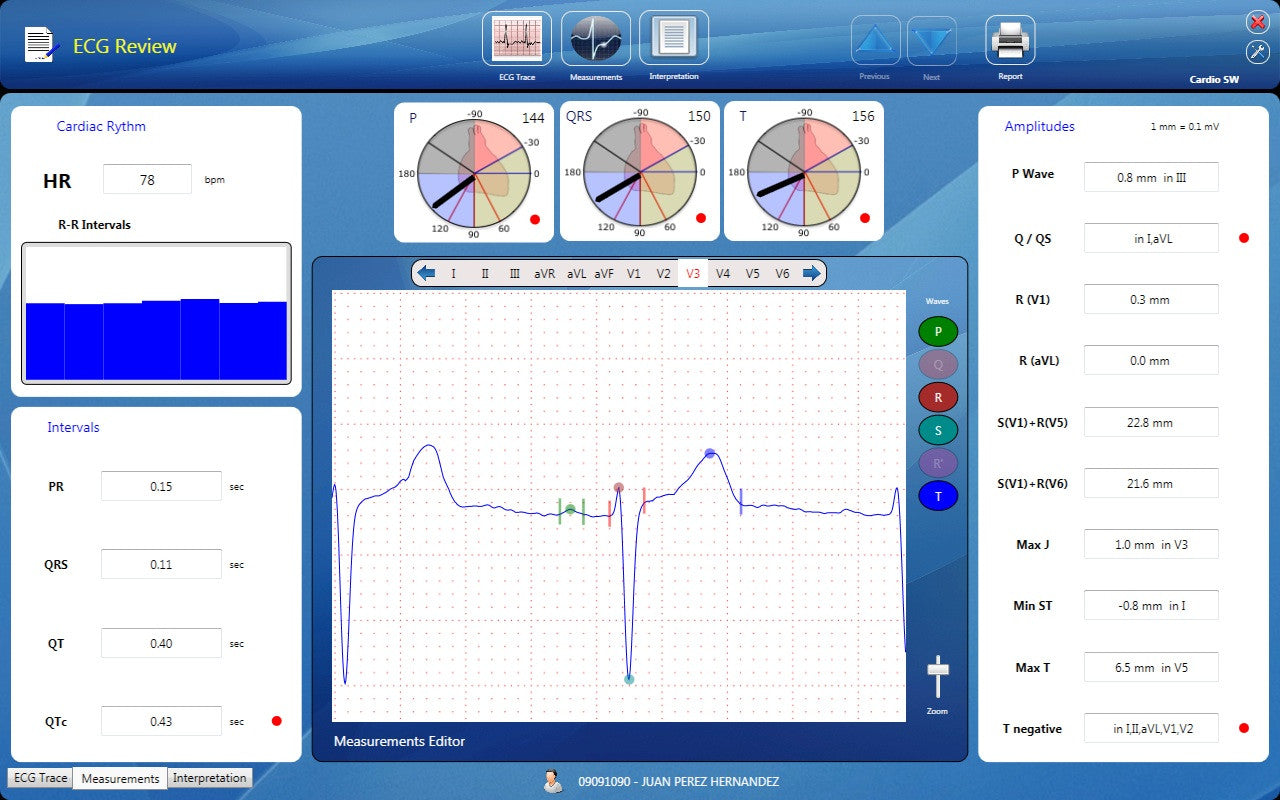 CardioSW - Rest ECG, Interpretation Software - Medical equipment / Equipo medico - Mediventa USA