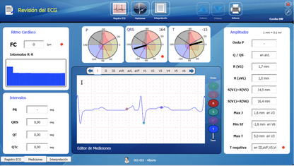 ECG Cardioview CV200