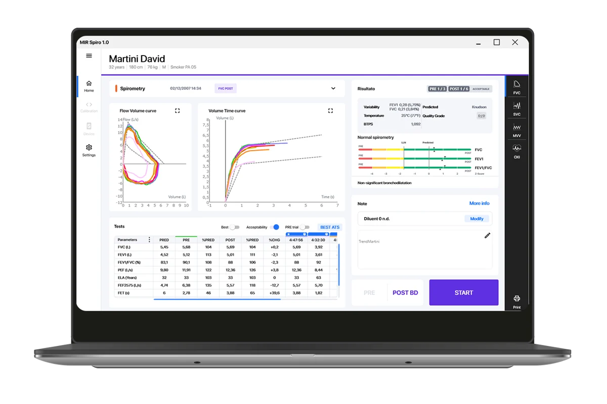 Licencia Mir Spiro Platinum