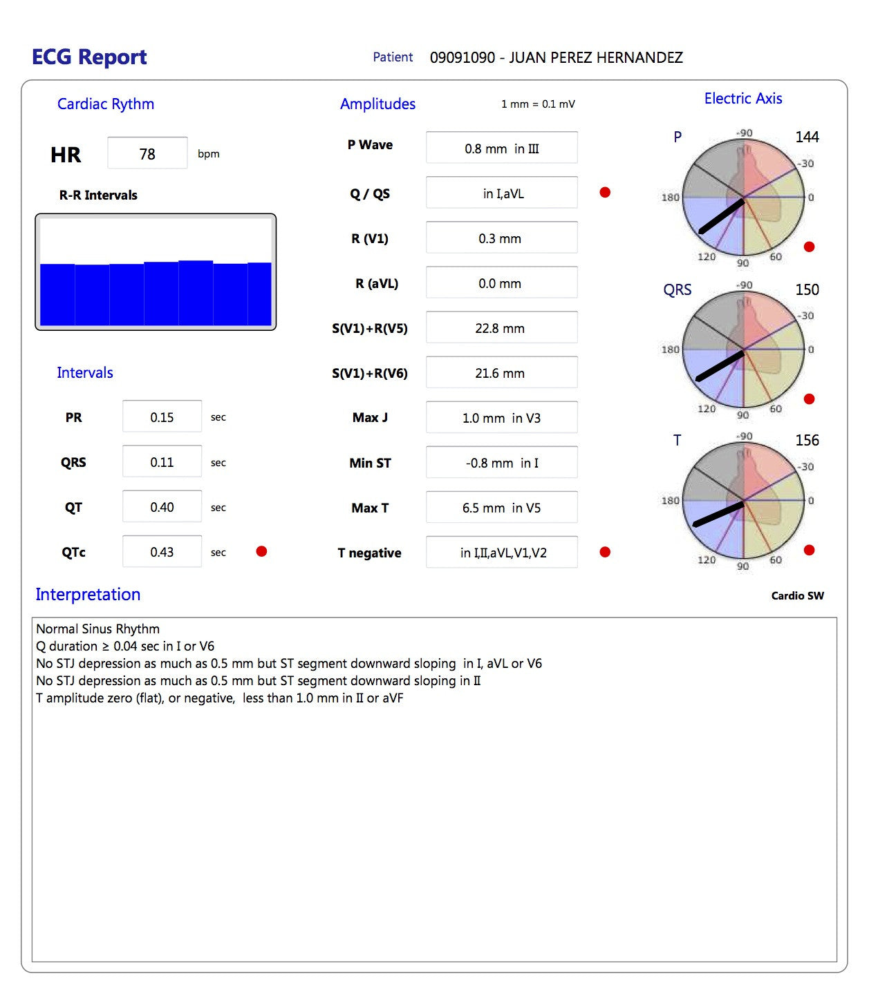 CardioSW - Rest ECG, Interpretation Software - Medical equipment / Equipo medico - Mediventa USA
