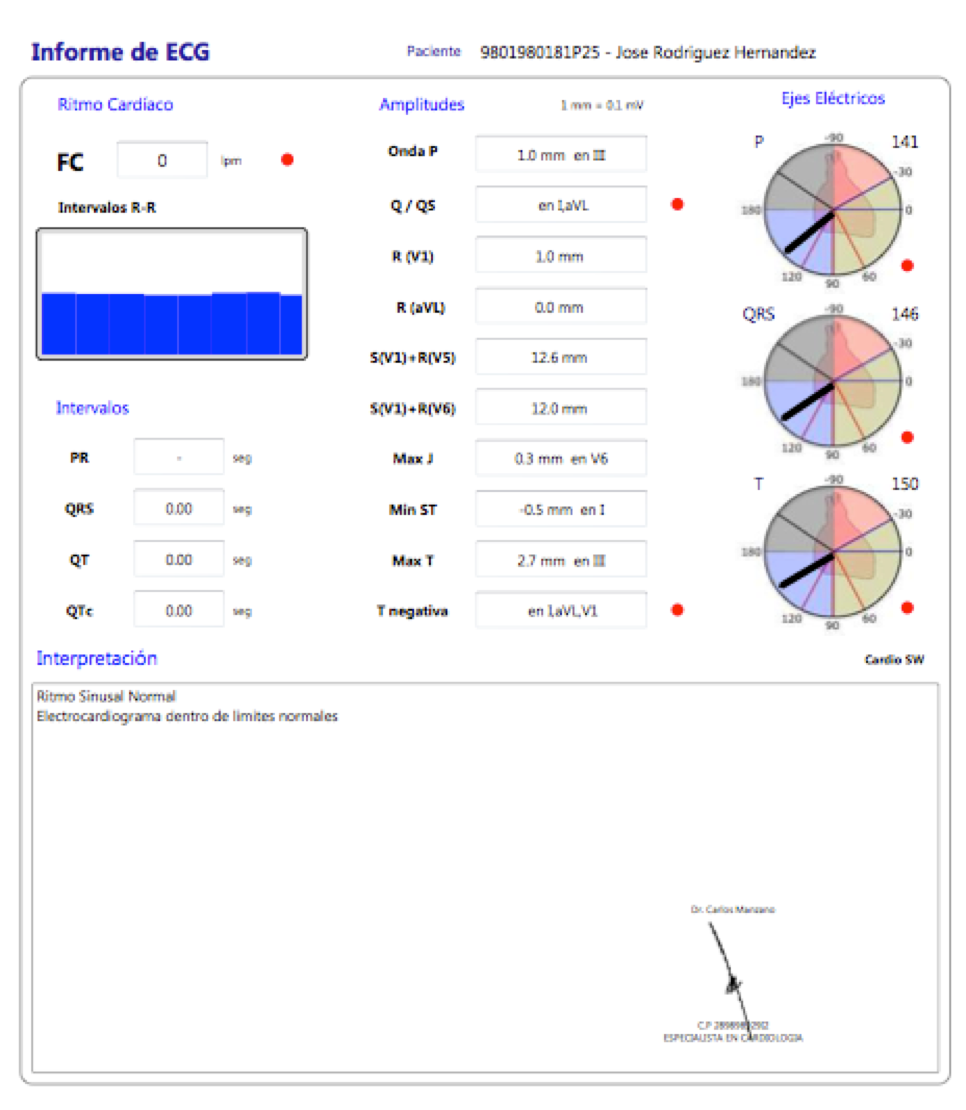 ECG Cardioview CV200