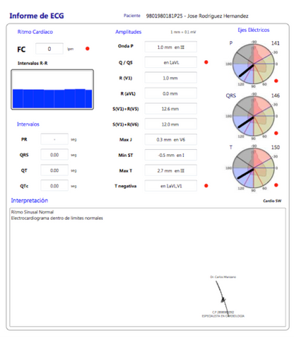 ECG Cardioview CV200