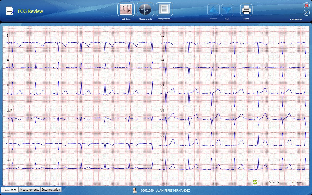 CardioSW - Rest ECG, Interpretation Software - Medical equipment / Equipo medico - Mediventa USA