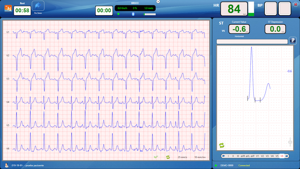 CardioView - CV1200, Electrocardiograph - Medical equipment / Equipo medico - Mediventa USA