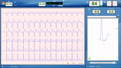 CardioView - CV1200, Electrocardiograph - Medical equipment / Equipo medico - Mediventa USA