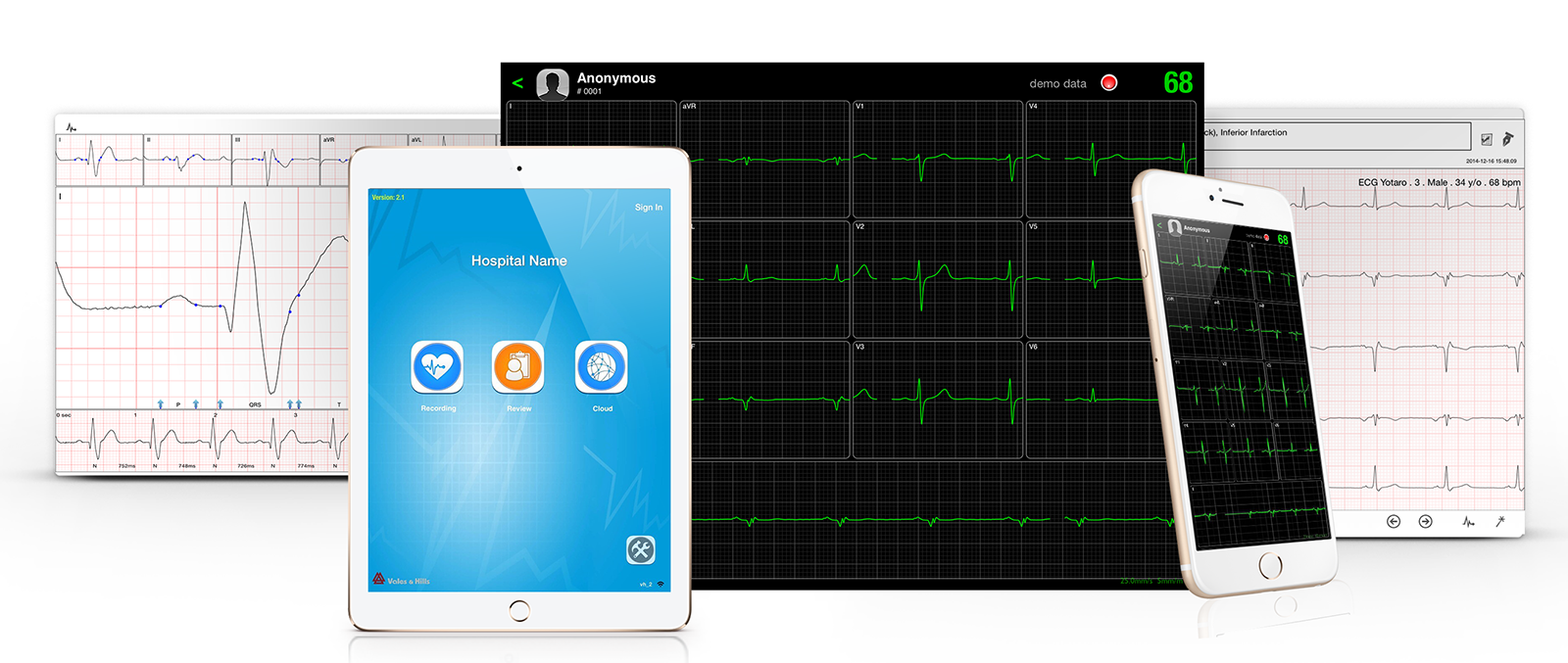 iCV200BLE Electrocardiograph for Ipad, Electrocardiograph - Medical equipment / Equipo medico - Mediventa USA