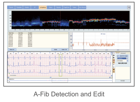 CardioSW - Holter, Interpretation Software - Medical equipment / Equipo medico - Mediventa USA