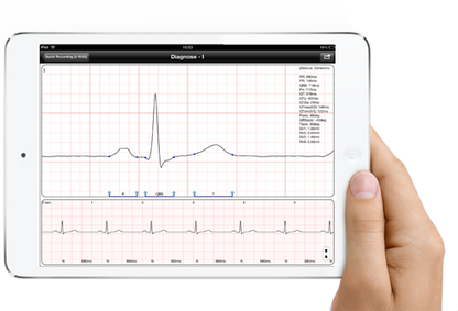 Professional Digital Electrocardiograph iCV200BLE for iOS and Mac, Electrocardiograph - Medical equipment / Equipo medico - Mediventa USA