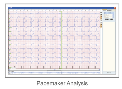CardioSW - Holter, Interpretation Software - Medical equipment / Equipo medico - Mediventa USA