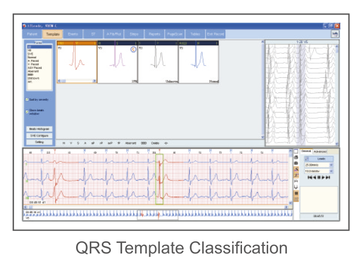 CardioSW - Holter, Interpretation Software - Medical equipment / Equipo medico - Mediventa USA