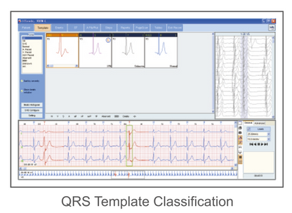 CardioSW - Holter, Interpretation Software - Medical equipment / Equipo medico - Mediventa USA