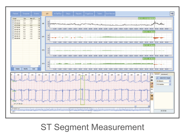 CardioSW - Holter, Interpretation Software - Medical equipment / Equipo medico - Mediventa USA