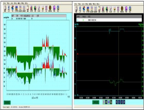 Monitor Ambulatorio de Presion Arterial - ABPM50